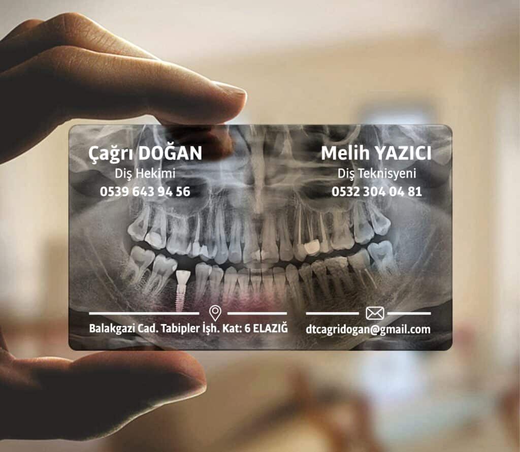 Diş Hekimi Şeffaf Kartvizit 1024x890 - Şeffaf Kartvizit